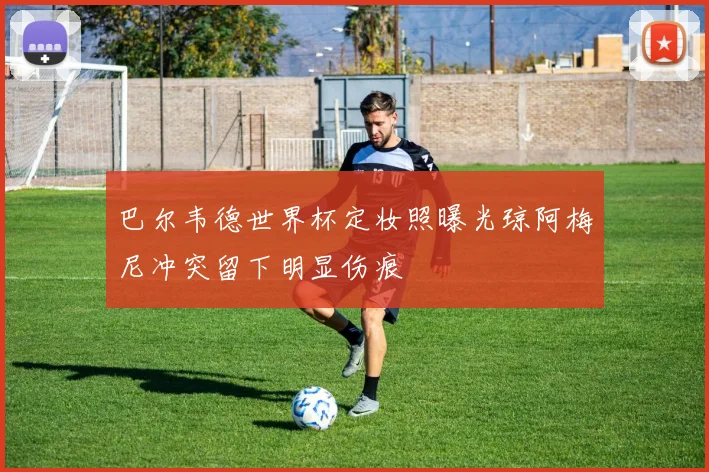 巴尔韦德世界杯定妆照曝光琼阿梅尼冲突留下明显伤痕